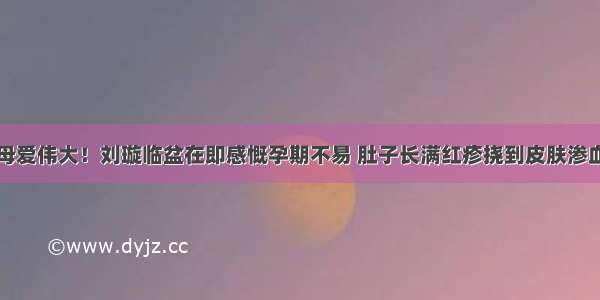 母爱伟大！刘璇临盆在即感慨孕期不易 肚子长满红疹挠到皮肤渗血