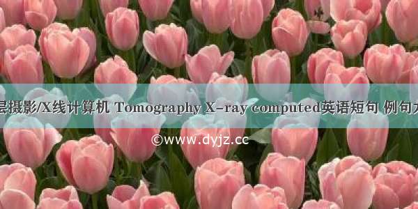 体层摄影/X线计算机 Tomography X-ray computed英语短句 例句大全