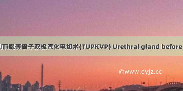 经尿道前列前腺等离子双极汽化电切术(TUPKVP) Urethral gland before the forefr